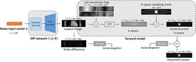 A hybrid deep image prior and compressed sensing reconstruction method for highly accelerated 3D coronary magnetic resonance angiography